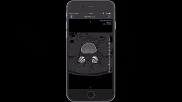 craig_purview mobile medical imaging 3d medical images dicom imaging GIF