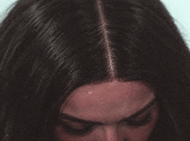 Megan Fox Plastic Surgery GIF
