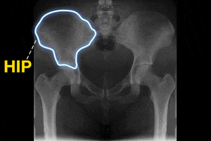 Digital art gif. The hip bones of a human torso X ray light up one at a time. Yellow text, "Hip, hip, Hooray!"