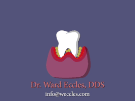 karlpontau teeth dentist dentistry ward eccles GIF