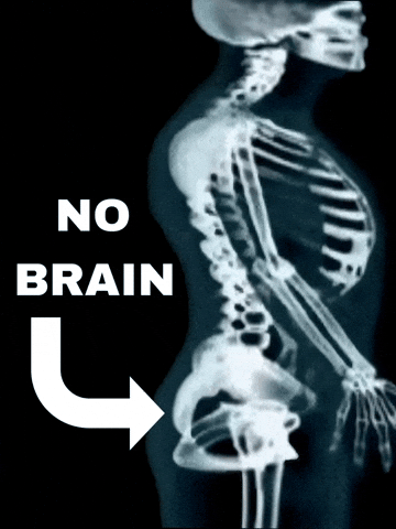 No Brain GIF