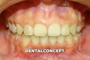 davidantoniovilcaobregon dentalconcept GIF