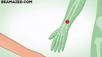 Pc-6 Forearm GIF