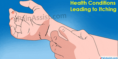 health conditions leading to itching GIF by ePainAssist