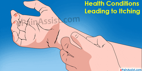 health conditions leading to itching