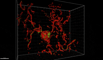 brain cgi GIF by Harvard Medical School