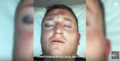 Tommy Robinson GIF