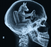Brain Donkey GIF