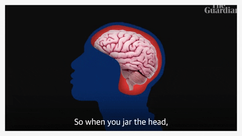 Brain-in-a-jar GIFs - Get the best GIF on GIPHY