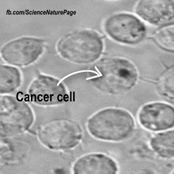 cancer cells GIF