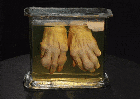 hands gout GIF by Mütter Museum