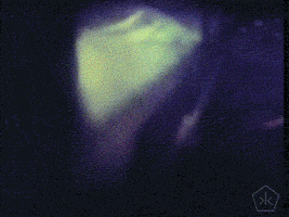 200.gif?cid=fc005b08447dbbc00636a41f8e0605781f555563b91b813b&rid=200.gif&ct=g