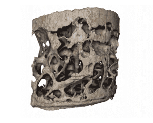 bone