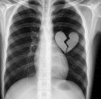 Broken Heart GIF