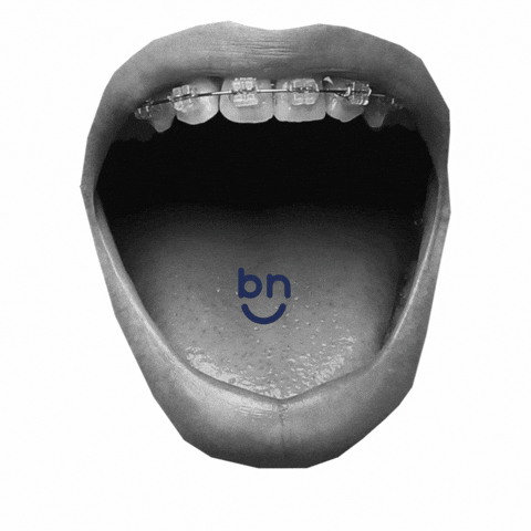 Braces Now GIFs on GIPHY - Be Animated
