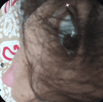 Closeup Shortie GIF
