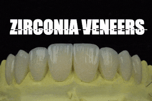 Apostol Dental GIF