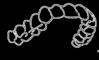 Alinhadores Moov GIF