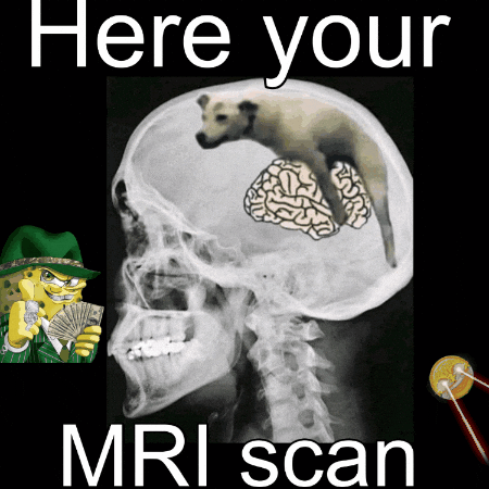 Mindfuck Are You Dumb GIF