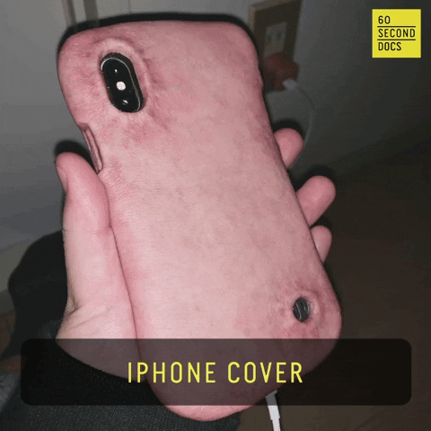 Iphone Skin GIF by 60 Second Docs