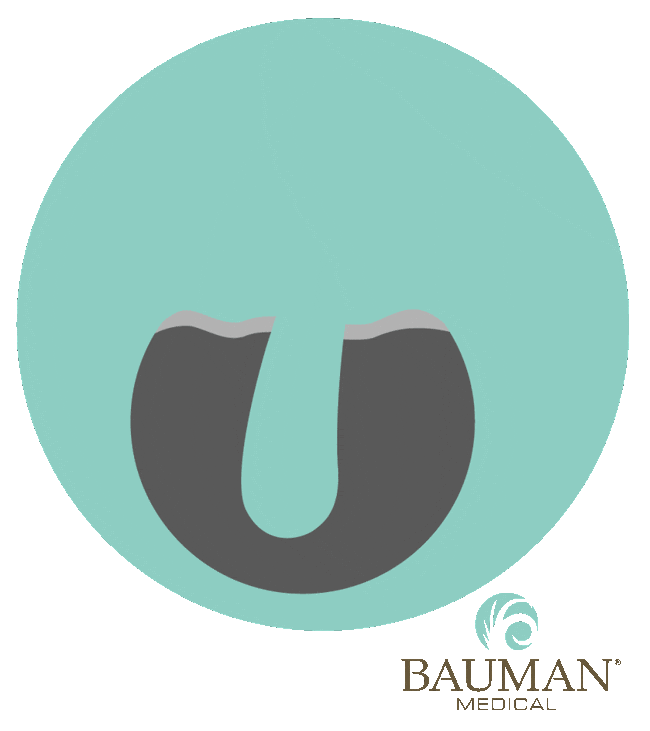 Hair Growth Sticker by baumanmedical