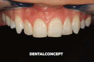 davidantoniovilcaobregon dentalconcept GIF