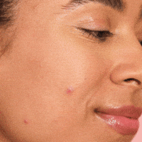 Pimple Patch