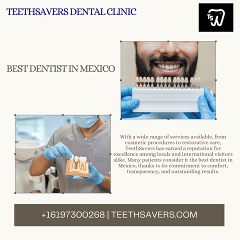 Best Dentist In Mexico GIF