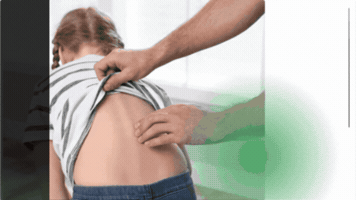 مركز علاج الجنف GIF