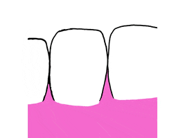 Dente GIF