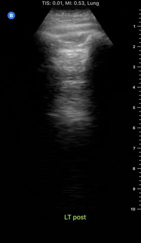 Covid-19 GIF