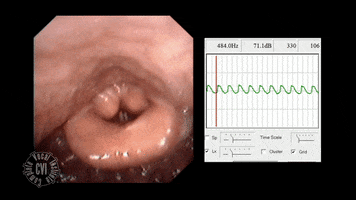 cvi twang complete vocal technqiue GIF