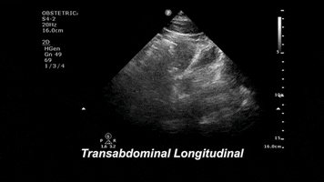 drjeffy foamed foamus GIF