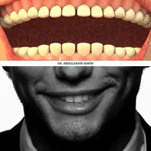 Dentist GIF