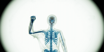 X Ray Radio GIF by Alan