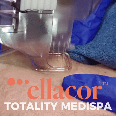 Ellacor GIF by Totality Medispa