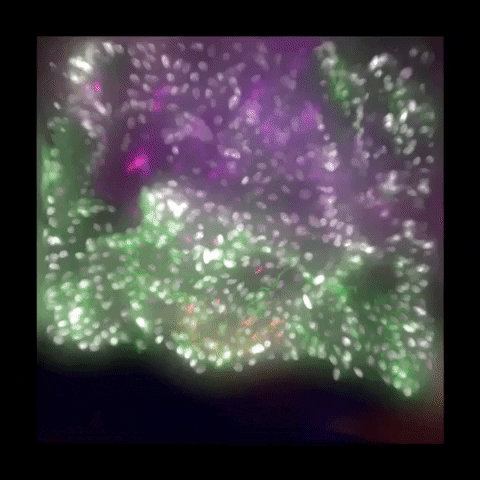 LeicaMicrosystems microscope haze microscopy leica microsystems GIF