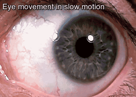 slow mo