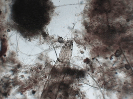 Microscopy Organism GIF by DIIMSA Stock