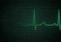 heartbeat line gif