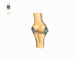 Inflamed Knee Bones GIF