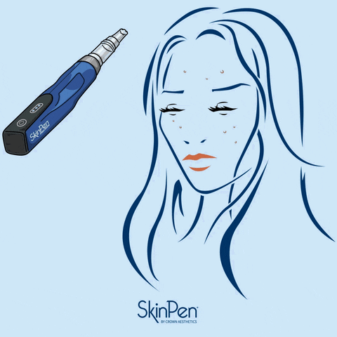 The SkinPen GIF
