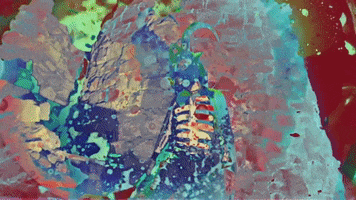 200.gif?cid=fc005b081e2a18f30591d541e0e87626f0a87b1bf678e9a9&rid=200.gif&ct=g
