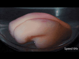 aczewe science brain research harvard GIF