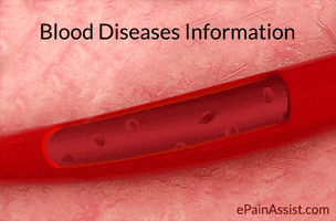 blood disorders information center GIF by ePainAssist