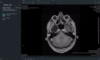craig_purview purview viva web-based dicom web dicom viewer cloud pacs GIF