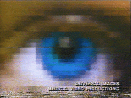 Video gif. A blurry, lo-fi close-up of a blue eye, with VHS static across the bottom edge. Text, "Universal Images, Medical Video Productions."