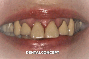 davidantoniovilcaobregon dentalconcept GIF