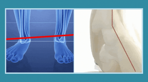Sapato Ortopédico ConfortPlus – EvolutionLifestyle.Store