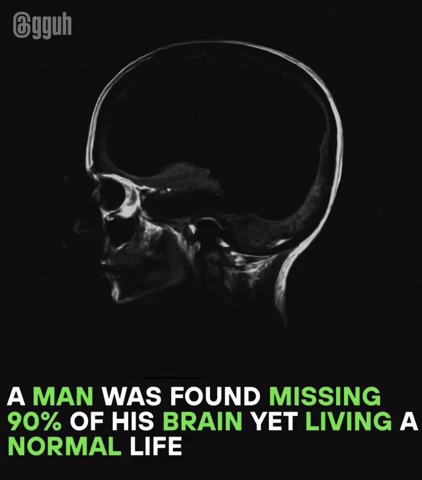 Brainless GIF
